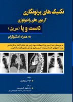 تکنیک های پرتونگاری آزمون های رادیولوژی دست و پا مریل۲۰۱۹
